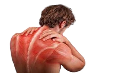 Muscle Pain