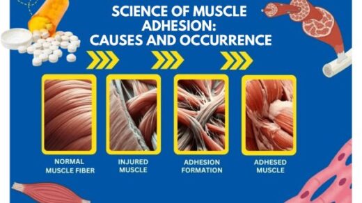 Types of Muscle Adhesion